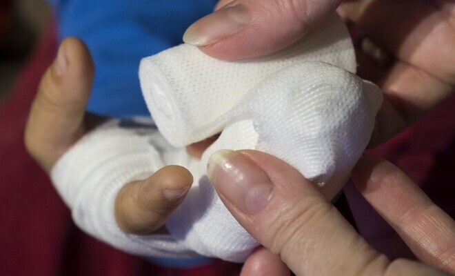 Cero tolerancia con las quemaduras de pólvora en nuestra familia policial