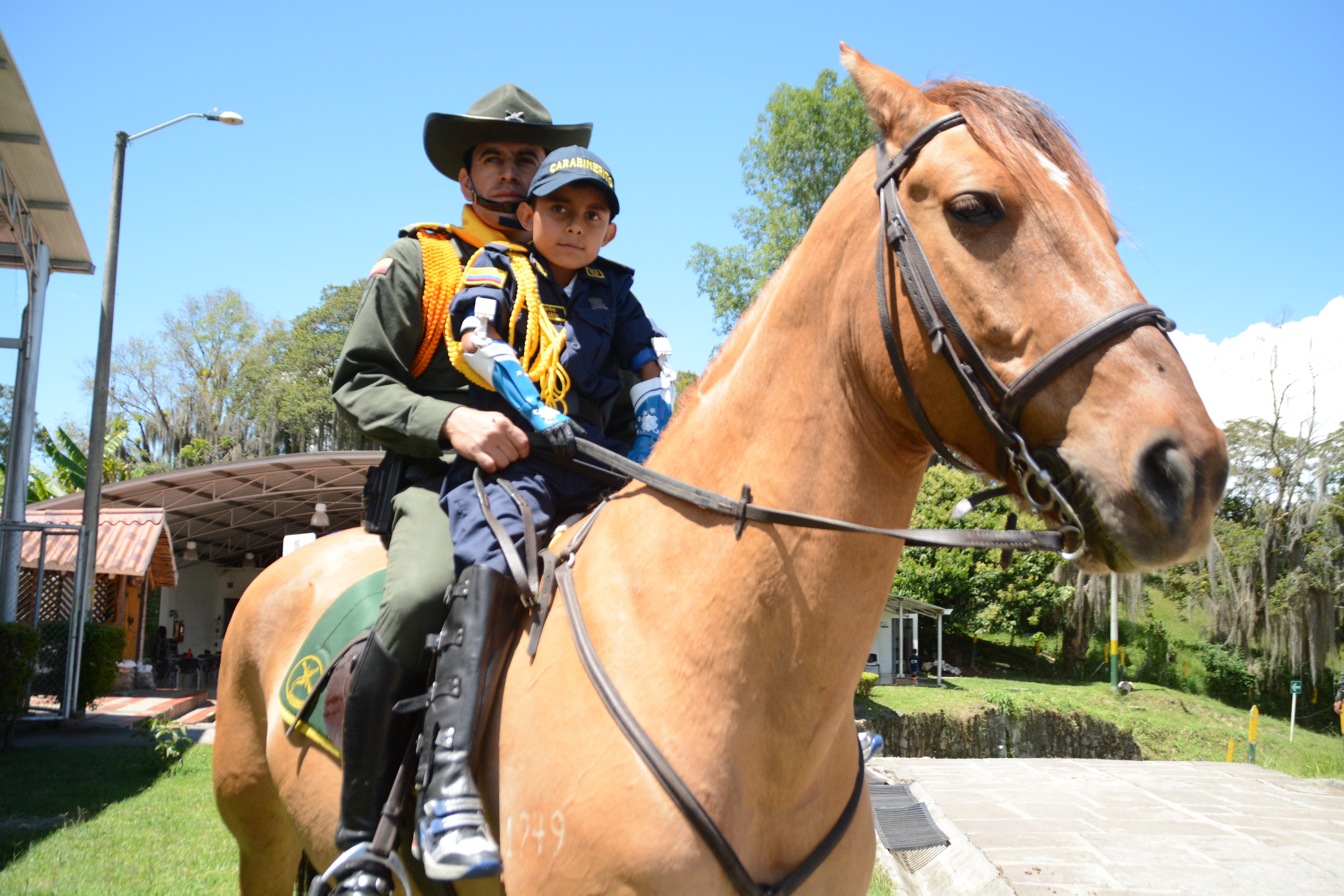 Entrega Prótesis Animadas Dairo -Policía de Santander